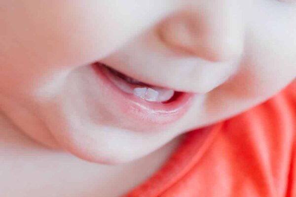 Bebeklerde Diş Sağlığı ve emzik