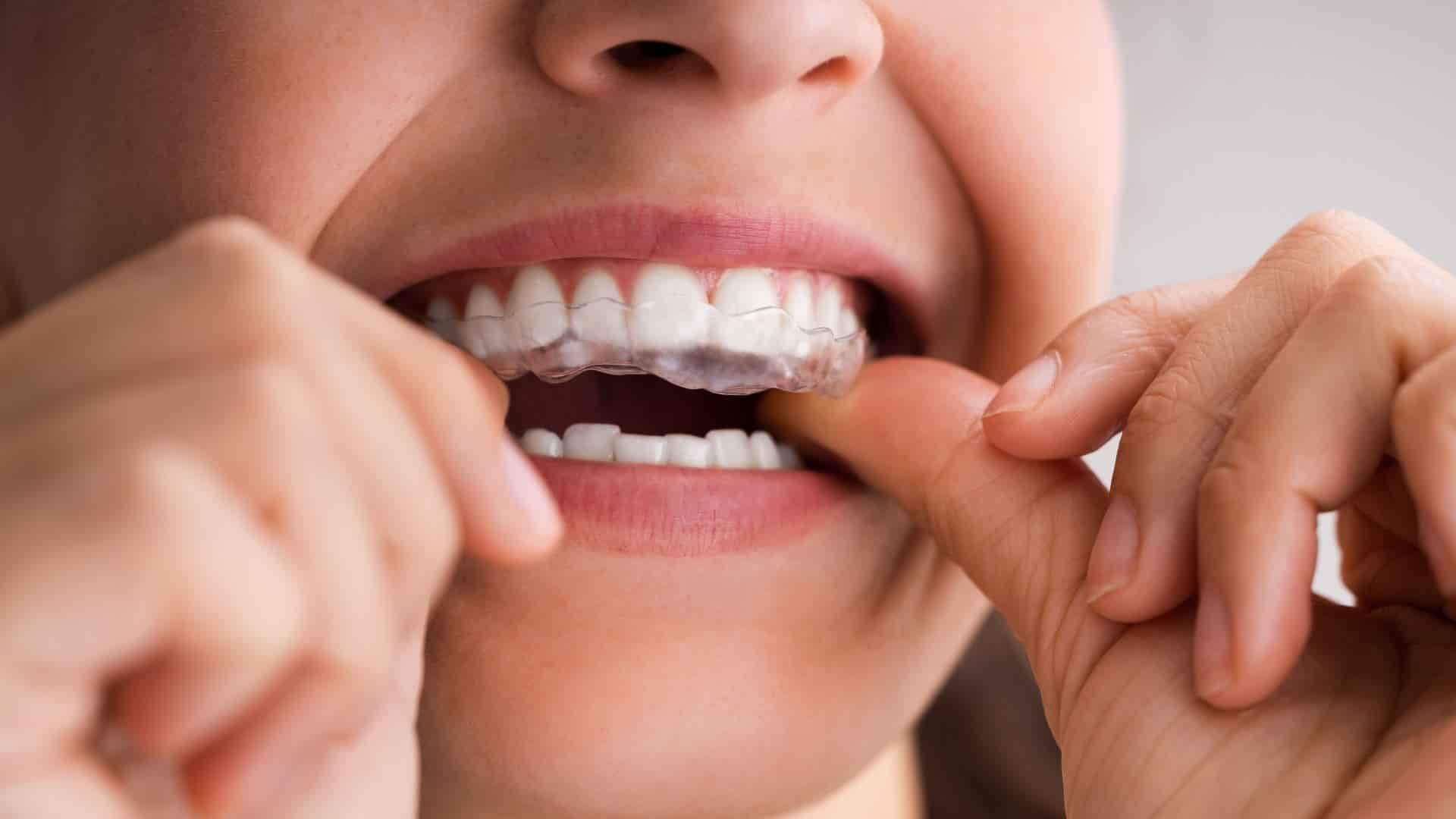 Bruksizm nedir?